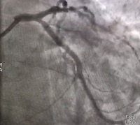 Слаженная работа центра помогла оказать экстренную помощь