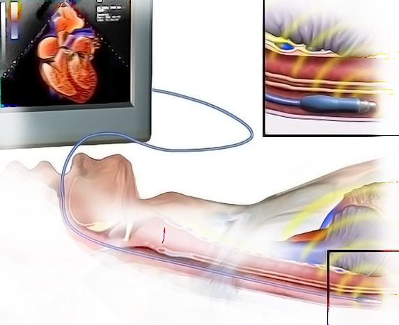 Планируется к введению в список услуг центра чреспищеводная эхокардиография